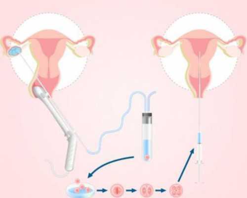 <strong>平凉代孕中心靠谱吗,潜江试管婴儿成功率高吗</strong>