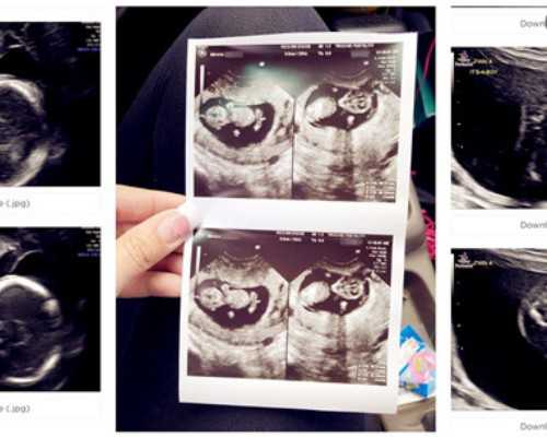 涪陵民间代孕中心,【广西梧州试管】梧州做试管婴儿合适的年龄