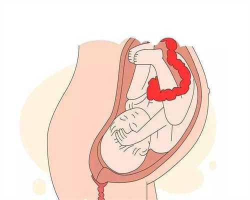 西安代孕生子代孕网:刮宫两次以后会代孕吗