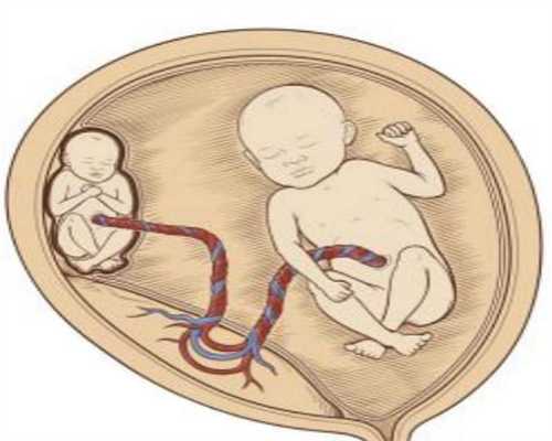 西安代孕详细过程:胎儿打嗝是因为妈妈吃多了 真的吗