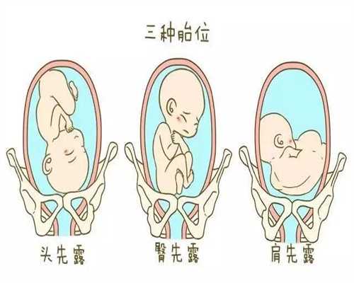 代孕有哪三种类型_孕妇喝牛奶的好处，孕妇喝牛奶注意事项