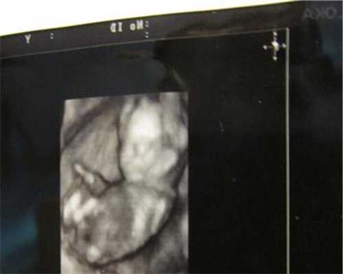 西安代怀孕助孕:三个合适做胎教的时间段