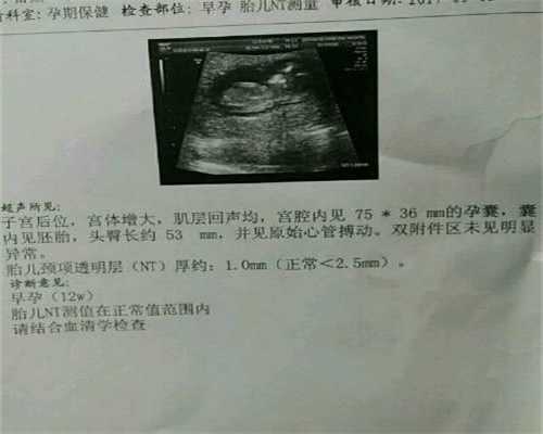 西安代怀生宝宝孩子:孕37周胎儿发育标准是怎样的