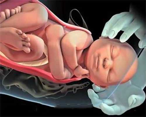 西安代孕中介靠谱吗:新生儿脖子脓包怎么回事