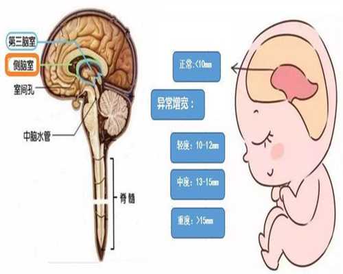 西安代怀代生男宝宝:宝宝发低烧的原因及相关介绍