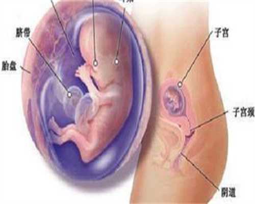 包成功代孕要多少钱_怀孕45天未见胚芽是为什么？