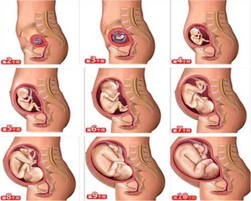 哪家三甲医院可以做代孕_怀孕初期喝了一杯啤酒有影响吗